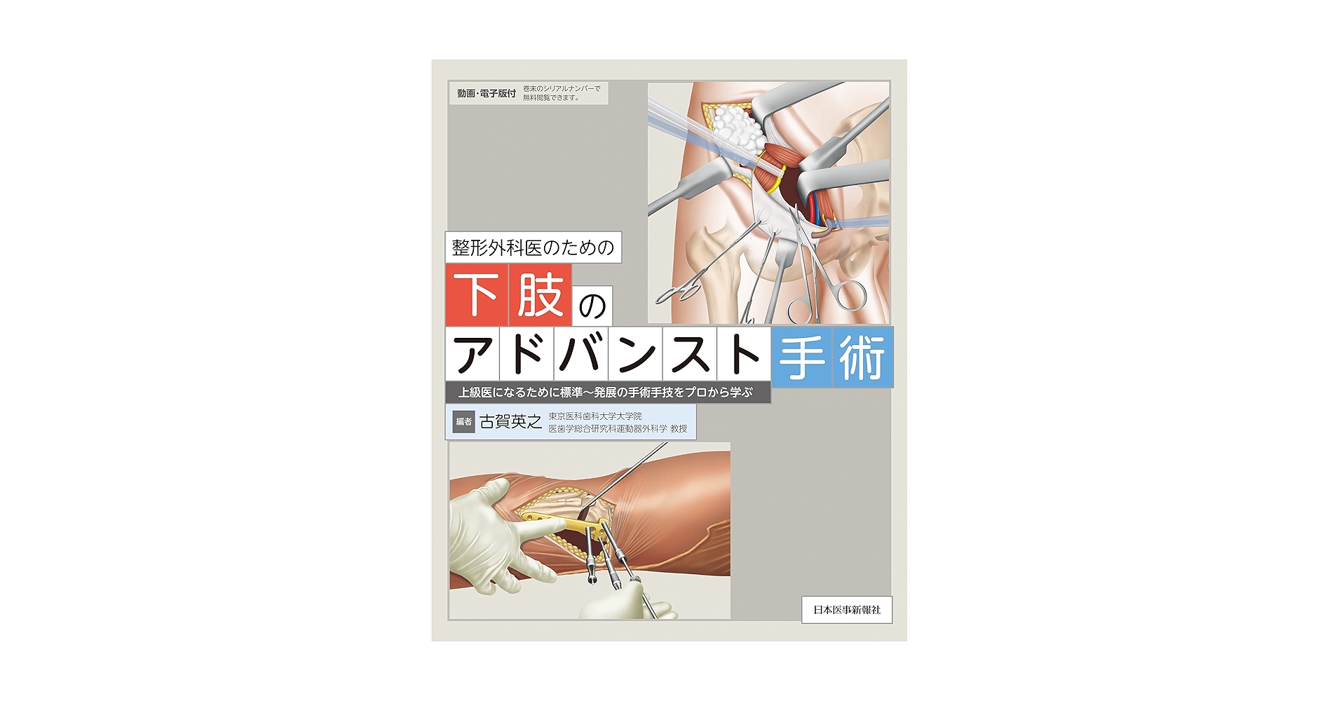 【裁断済み】整形外科医のための脊椎のアドバンスト手術 整形外科医のための脊椎のアドバンスト手術 | 石井 賢 |本